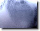 Chirurgie m�kk�ch tk�n�